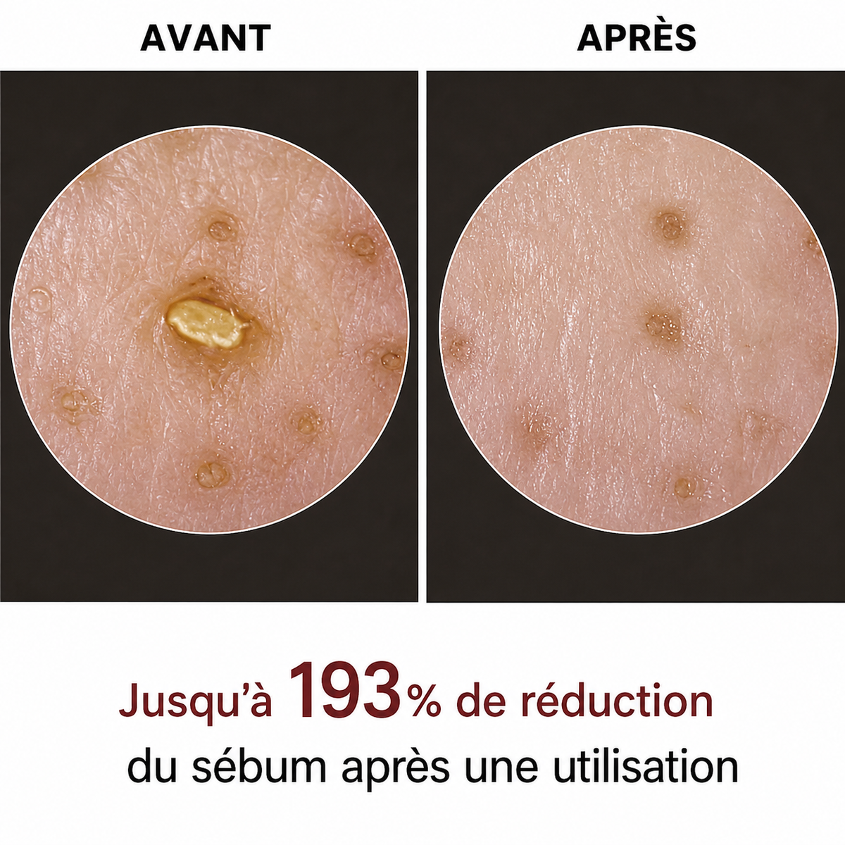 Peel Shot - Élimine les Impuretés et Sublime Votre Peau