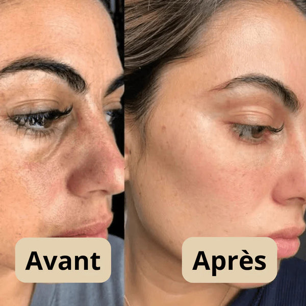 Peel Shot - Élimine les Impuretés et Sublime Votre Peau