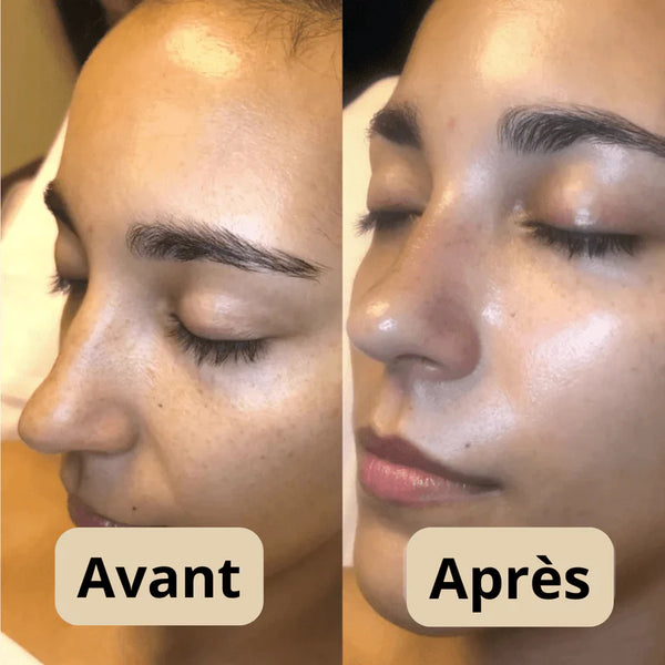 Peel Shot - Élimine les Impuretés et Sublime Votre Peau